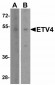 ETV4 Antibody