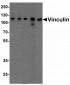 Vinculin Antibody