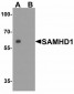 SAMHD1 Antibody