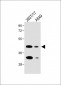 FOLR1 Antibody (N-term)