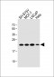 PARK7 Antibody (C-term)