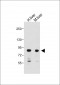 MUT Antibody (N-Term)