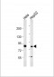 MUT Antibody (N-Term)