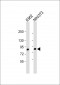 MUT Antibody (Center)
