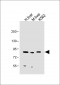 MUT Antibody (Center)