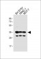 OR5V1 Antibody (C-term)
