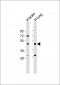 IFT57 Antibody (Center)