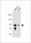 DEPDC1 Antibody (N-term)