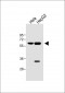 IL1R Antibody (C-term E487)