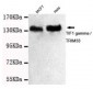 Anti-TIF1 gamma Antibody (3H7-C8-B9)
