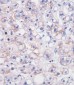 CDH1 Antibody