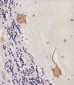 CAMK2 beta Antibody (C-term)