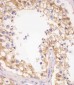 PDXK Antibody (N-term)
