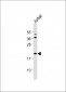 Bid Antibody (BH3 Domain Specific)