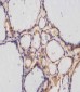 TERT Antibody (S1125)