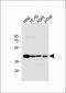 HLA-B Antibody (N-term)