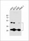 CTSD Antibody