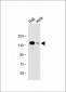 UBE4B Antibody (N-term)