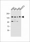 UBE4B Antibody (N-term)
