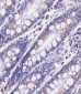 PABPC3 Antibody (N-Term)