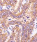 HSD17B10 Antibody (Center)