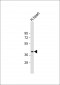 PD L1 Antibody (C-Term)