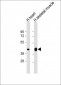 PD L1 Antibody (C-Term)