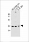 OR6C3 Antibody (Center)