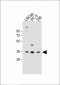 OR6C3 Antibody (Center)