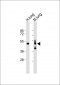 RAGE (AGER) Antibody (N-term)