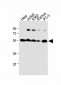 CALR Antibody (Center)