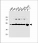 CALR Antibody (Center)