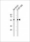 BACE Antibody (S498)