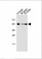 Activin A Receptor Type IB (ACVR1B) Antibody (N-term)