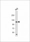 PI3KCD Antibody (C-term)