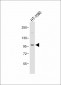 PI3KCD Antibody (C-term)