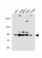 PI3KR1 Antibody (N-term L11)
