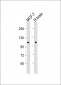 HK1 (Hexokinase) Antibody (N-term)