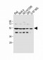 PFKFB4 Antibody (Center)