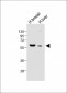 FADS2 Antibody (N-term)