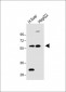 FADS2 Antibody (N-term)