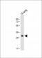 HLA-DPB1 Antibody (Center)