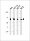 RBBP8 Antibody (C-term)