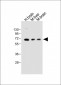 GLS2 Antibody (C-term E513)
