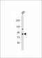 PKC epsilon Antibody (N-term)