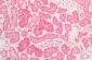 HSP60 Antibody
