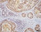 HSF1 Antibody