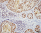 HSF1 Antibody