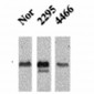 CaMKII Antibody