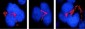 FKBP51 Antibody